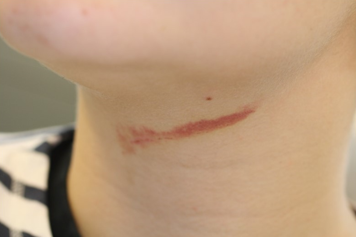 retsodontologi, odontologi, dsfro, www.dsfro.dk, 